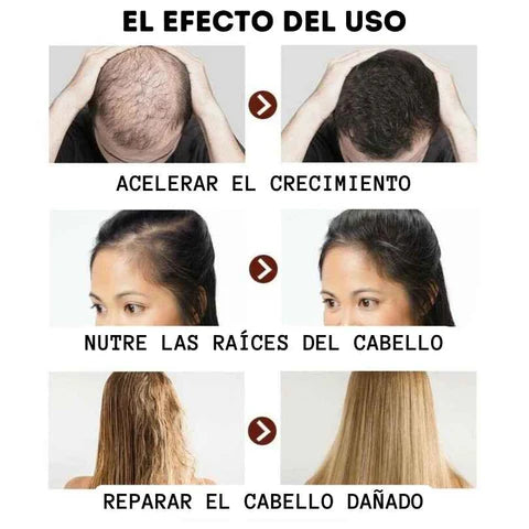 TONICO CAPILAR JENGIBRE CRECIMIENTO 30ML
