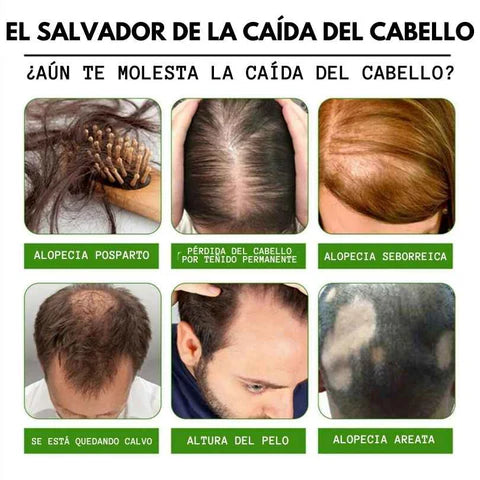 TONICO CAPILAR JENGIBRE CRECIMIENTO 30ML